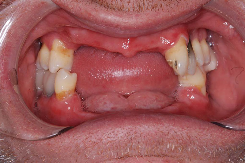 Before image